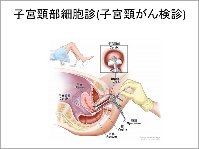 第2回らくわ健康教室 知っておきたい婦人科のがん おとまる健康ニュース