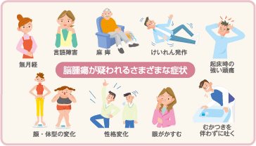 いち早く治療を 脳腫瘍 おとまる健康ニュース